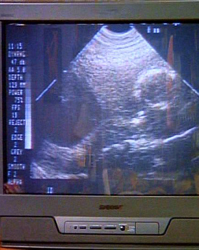 Friends,  Season 1 Episode 02: The One with the Sonogram At The End